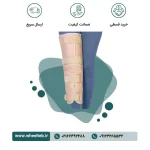 ثابت کننده زانو تک سایز - کد ۴۶۳۰۰